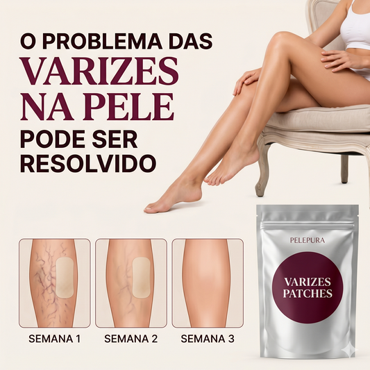Patches Varizes